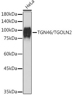 Invitrogen TGN46 Recombinant Rabbit Monoclonal Antibody (9G5X6) 100 &mu;L;