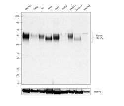 Invitrogen TGN46 Recombinant Rabbit Monoclonal Antibody (9G5X6) 100 &mu;L;