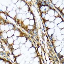 Invitrogen ABCF1 Recombinant Rabbit Monoclonal Antibody (4P9V8) 100 &mu;L;