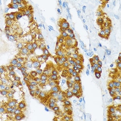 Invitrogen CD298 Recombinant Rabbit Monoclonal Antibody (0B7M7) 100 &mu;L:Antibodies,