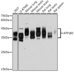 Invitrogen CD298 Recombinant Rabbit Monoclonal Antibody (0B7M7) 100 &mu;L:Antibodies,