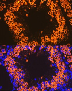 Invitrogen CLGN Recombinant Rabbit Monoclonal Antibody (8R8M1) 100 &mu;L:Antibodies,