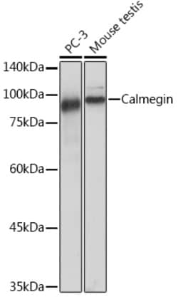 Invitrogen CLGN Recombinant Rabbit Monoclonal Antibody (8R8M1) 100 &mu;L:Antibodies,