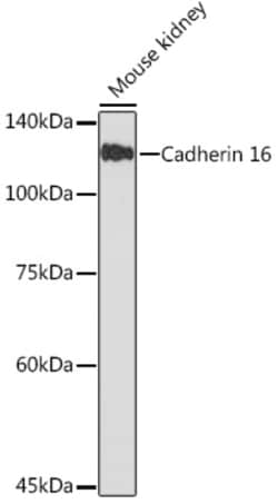 Invitrogen CDH16 Recombinant Rabbit Monoclonal Antibody (2J0H4) 100 &mu;L | Buy Online | Invitrogen&trade; | Fisher Scientific