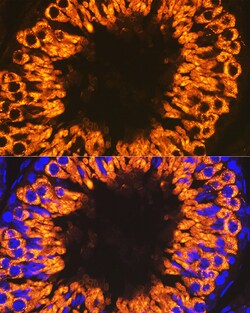 Invitrogen CLGN Recombinant Rabbit Monoclonal Antibody (6U8D7) 100 &mu;L:Antibodies,