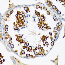 Invitrogen CLGN Recombinant Rabbit Monoclonal Antibody (6U8D7) 100 &mu;L:Antibodies,