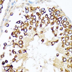 Invitrogen CLGN Recombinant Rabbit Monoclonal Antibody (6U8D7) 100 &mu;L:Antibodies,