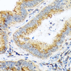 Invitrogen alpha COP Recombinant Rabbit Monoclonal Antibody (3W6Y6) 100