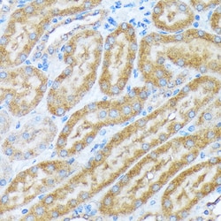 Invitrogen alpha COP Recombinant Rabbit Monoclonal Antibody (3W6Y6) 100