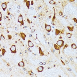 Invitrogen alpha COP Recombinant Rabbit Monoclonal Antibody (3W6Y6) 100