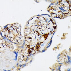 Invitrogen Fibrinogen alpha chain Recombinant Rabbit Monoclonal Antibody
