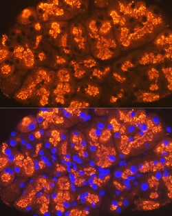 Invitrogen CTRL Recombinant Rabbit Monoclonal Antibody (10Z4K3) 100 &mu;L:Antibodies,