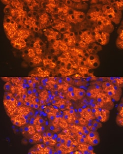 Invitrogen CTRL Recombinant Rabbit Monoclonal Antibody (10Z4K3) 100 &mu;L:Antibodies,