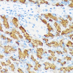 Invitrogen CTRL Recombinant Rabbit Monoclonal Antibody (10Z4K3) 100 &mu;L:Antibodies,