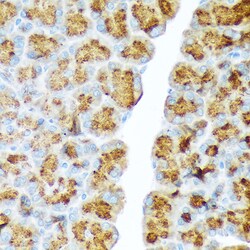 Invitrogen CTRL Recombinant Rabbit Monoclonal Antibody (10Z4K3) 100 &mu;L:Antibodies,