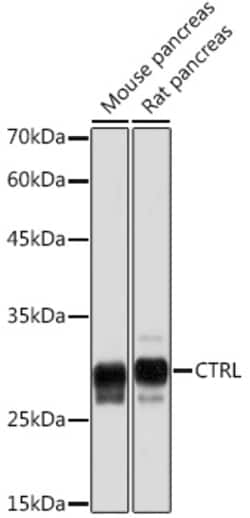 Invitrogen CTRL Recombinant Rabbit Monoclonal Antibody (10Z4K3) 100 &mu;L:Antibodies,