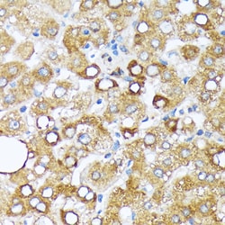 Invitrogen CYP4A11/CYP4A22 Recombinant Rabbit Monoclonal Antibody (10D10W7)