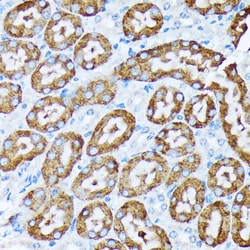 Invitrogen CYP4A11/CYP4A22 Recombinant Rabbit Monoclonal Antibody (10D10W7)