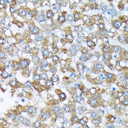 Invitrogen CYP4A11/CYP4A22 Recombinant Rabbit Monoclonal Antibody (10D10W7)