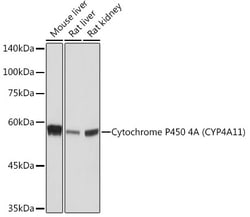 Invitrogen CYP4A11/CYP4A22 Recombinant Rabbit Monoclonal Antibody (10D10W7)
