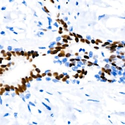 Invitrogen Progesterone Receptor Recombinant Rabbit Monoclonal Antibody