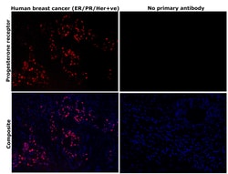 Invitrogen Progesterone Receptor Recombinant Rabbit Monoclonal Antibody