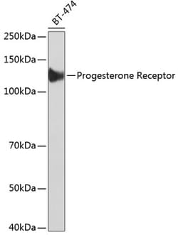 Invitrogen Progesterone Receptor Recombinant Rabbit Monoclonal Antibody