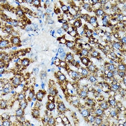 Invitrogen HSPA4 Recombinant Rabbit Monoclonal Antibody (10A9C5) 100 &mu;L;