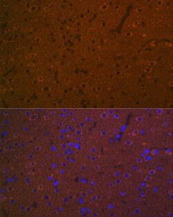 Invitrogen HTR7 Recombinant Rabbit Monoclonal Antibody (4E6D2) 100 &mu;L | Buy Online | Invitrogen&trade; | Fisher Scientific