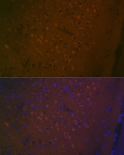 Invitrogen HTR7 Recombinant Rabbit Monoclonal Antibody (4E6D2) 100 &mu;L | Buy Online | Invitrogen&trade; | Fisher Scientific