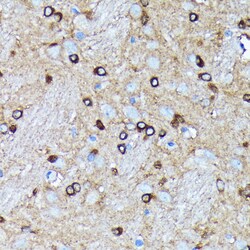 Invitrogen AGO2 Recombinant Rabbit Monoclonal Antibody (10S10L5) 100 &mu;L;