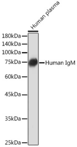Invitrogen Human IgM Recombinant Rabbit Monoclonal Antibody (6F7T2) 100 &mu;L | Buy Online | Invitrogen&trade; | Fisher Scientific