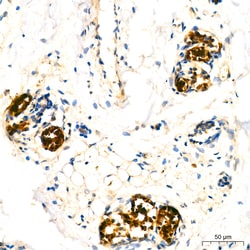 Invitrogen Mammaglobin A Recombinant Rabbit Monoclonal Antibody (3V10X9)