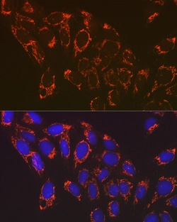 Invitrogen NDUFB8 Recombinant Rabbit Monoclonal Antibody (6T8G1) 100 &mu;L;