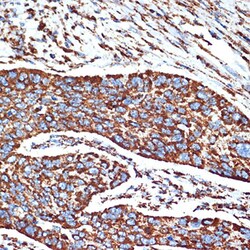 Invitrogen NDUFB8 Recombinant Rabbit Monoclonal Antibody (6T8G1) 100 &mu;L;
