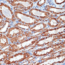Invitrogen NDUFB8 Recombinant Rabbit Monoclonal Antibody (6T8G1) 100 &mu;L;