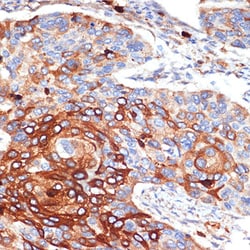 Invitrogen ORM1 Recombinant Rabbit Monoclonal Antibody (9L2J6) 100 &mu;L;