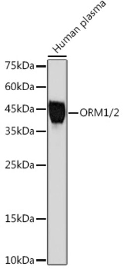 Invitrogen ORM1 Recombinant Rabbit Monoclonal Antibody (9L2J6) 100 &mu;L;