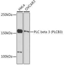 Invitrogen PLCB3 Recombinant Rabbit Monoclonal Antibody (4C0Z7) 100 &mu;L | Buy Online | Invitrogen&trade; | Fisher Scientific