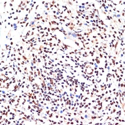 Invitrogen PAX9 Recombinant Rabbit Monoclonal Antibody (3C2U5) 100 &mu;L:Antibodies,