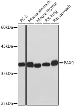 Invitrogen PAX9 Recombinant Rabbit Monoclonal Antibody (3C2U5) 100 &mu;L:Antibodies,