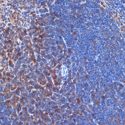 Invitrogen PIK3CD Recombinant Rabbit Monoclonal Antibody (3J0F6) 100 &mu;L;