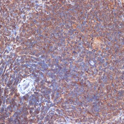 Invitrogen PIK3CD Recombinant Rabbit Monoclonal Antibody (3J0F6) 100 &mu;L;