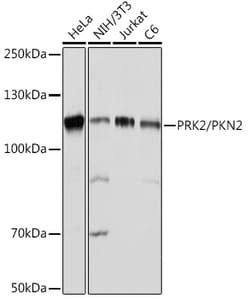 Invitrogen PKN2 Recombinant Rabbit Monoclonal Antibody (5O2G6) 100 &mu;L;