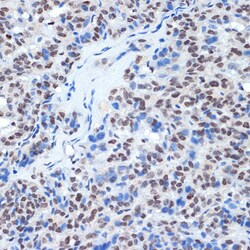 Invitrogen RING1 Recombinant Rabbit Monoclonal Antibody (2Q8D5) 100 &mu;L;