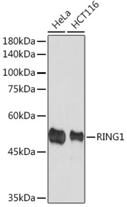 Invitrogen RING1 Recombinant Rabbit Monoclonal Antibody (2Q8D5) 100 &mu;L;