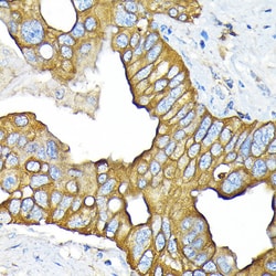 Invitrogen SLC22A3 Recombinant Rabbit Monoclonal Antibody (1K0A4) 100 &mu;L;
