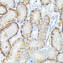 Invitrogen SLC22A3 Recombinant Rabbit Monoclonal Antibody (1K0A4) 100 &mu;L;