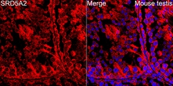 Invitrogen SRD5A2 Recombinant Rabbit Monoclonal Antibody (8A4H5) 100 &mu;L;