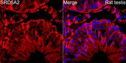 Invitrogen SRD5A2 Recombinant Rabbit Monoclonal Antibody (8A4H5) 100 &mu;L;